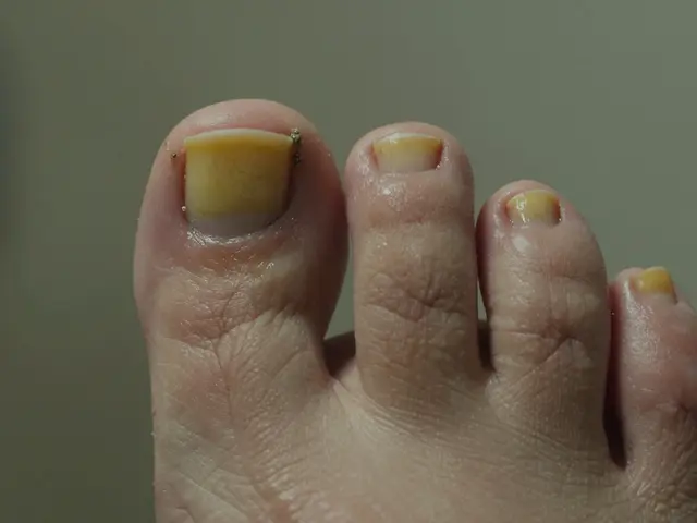 Proč mi smrdí nehty na nohou? Příčiny a jak to zastavit