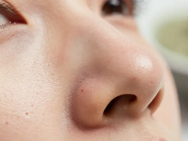 Jak odstranit černé tečky na nose přírodně: Ověřené metody a tipy